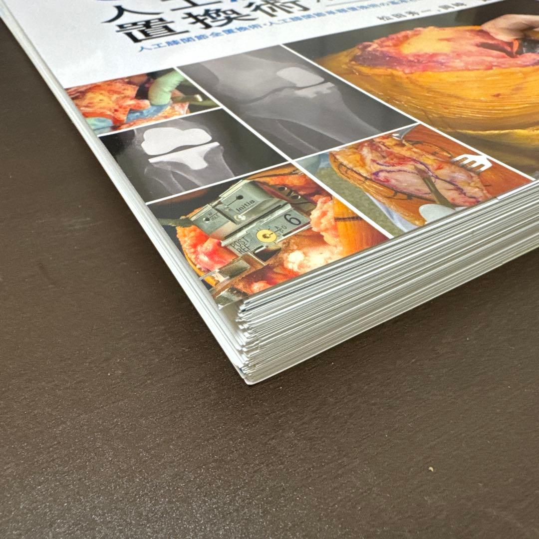 【裁断済】TKA・UKA 人工膝関節置換術パーフェクト