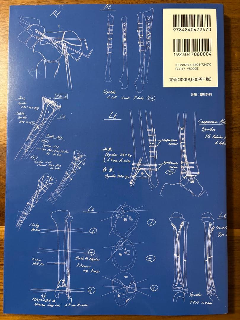 【裁断済】骨折の術前計画 55