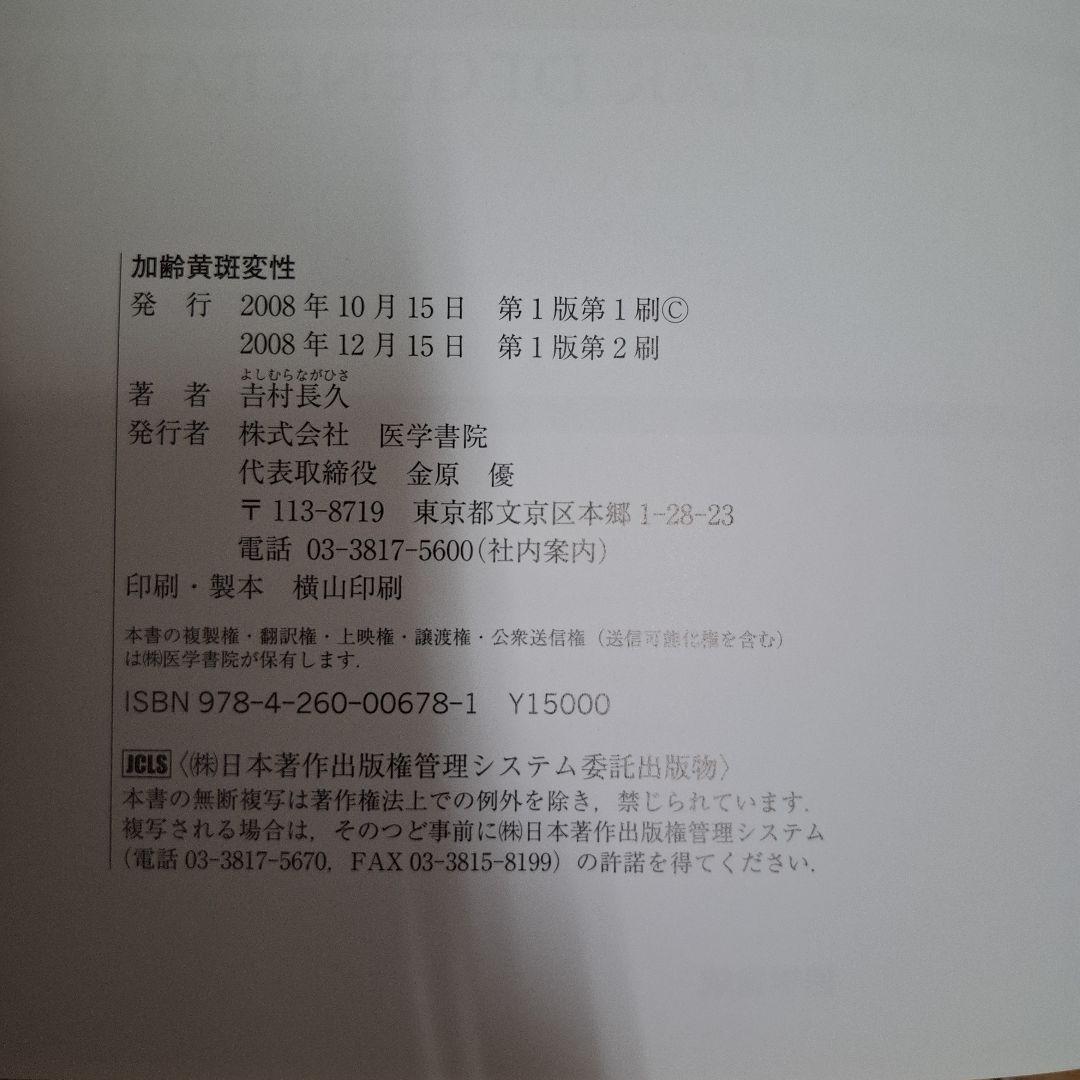 加齢黄斑変性