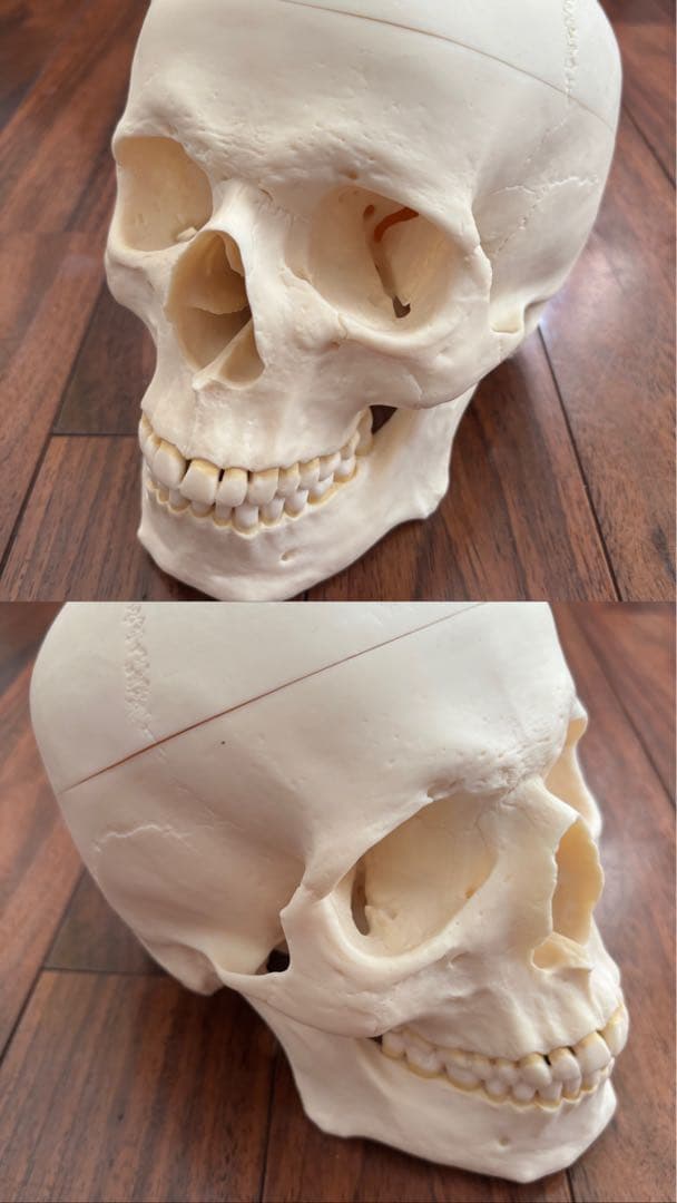 [SOMSO]頭蓋骨模型　【厳重包装】