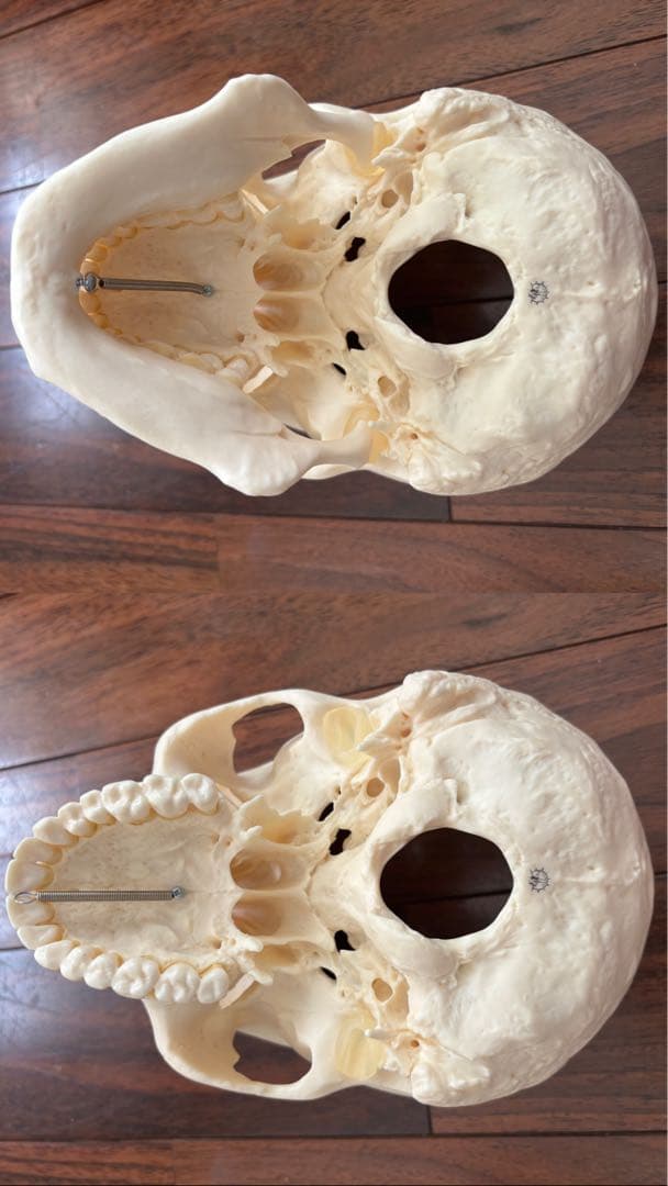 [SOMSO]頭蓋骨模型　【厳重包装】