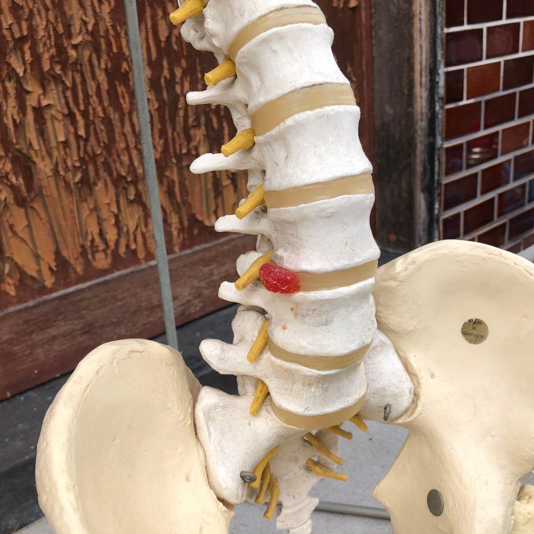 3B 脊椎模型 人体模型 スタンド付 骨格標本　骨盤　ドイツ製