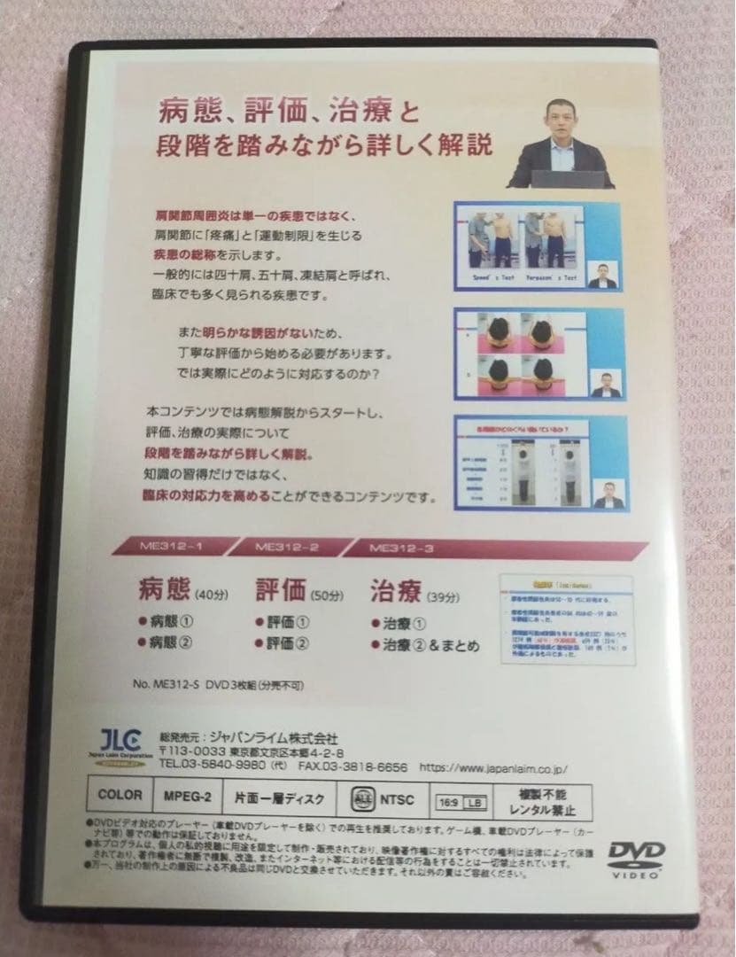 肩関節周囲炎に対する理学療法