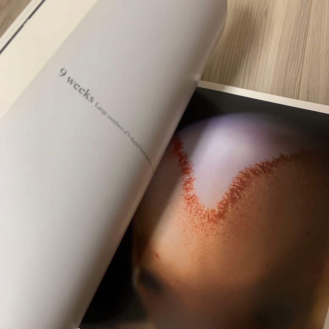 【英字版】A Child is Born 赤ちゃんの誕生